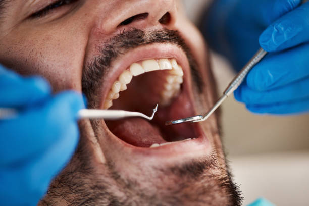 Best Emergency Denture Repair in Independent Hill, VA